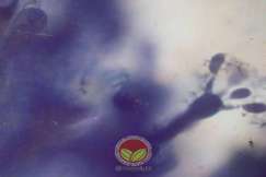 Simptom Penyakit Mati Rosot Vaskular (VSD)