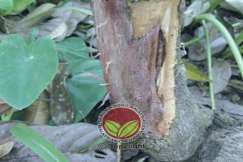 Simptom Penyakit Kanker