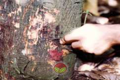 Simptom Penyakit Kanker