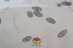 Simptom Penyakit Buah Perang