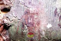 Simptom Penyakit Kanker