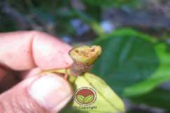 Simptom Penyakit Mati Rosot Vaskular (VSD)