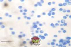 Simptom Penyakit Akar